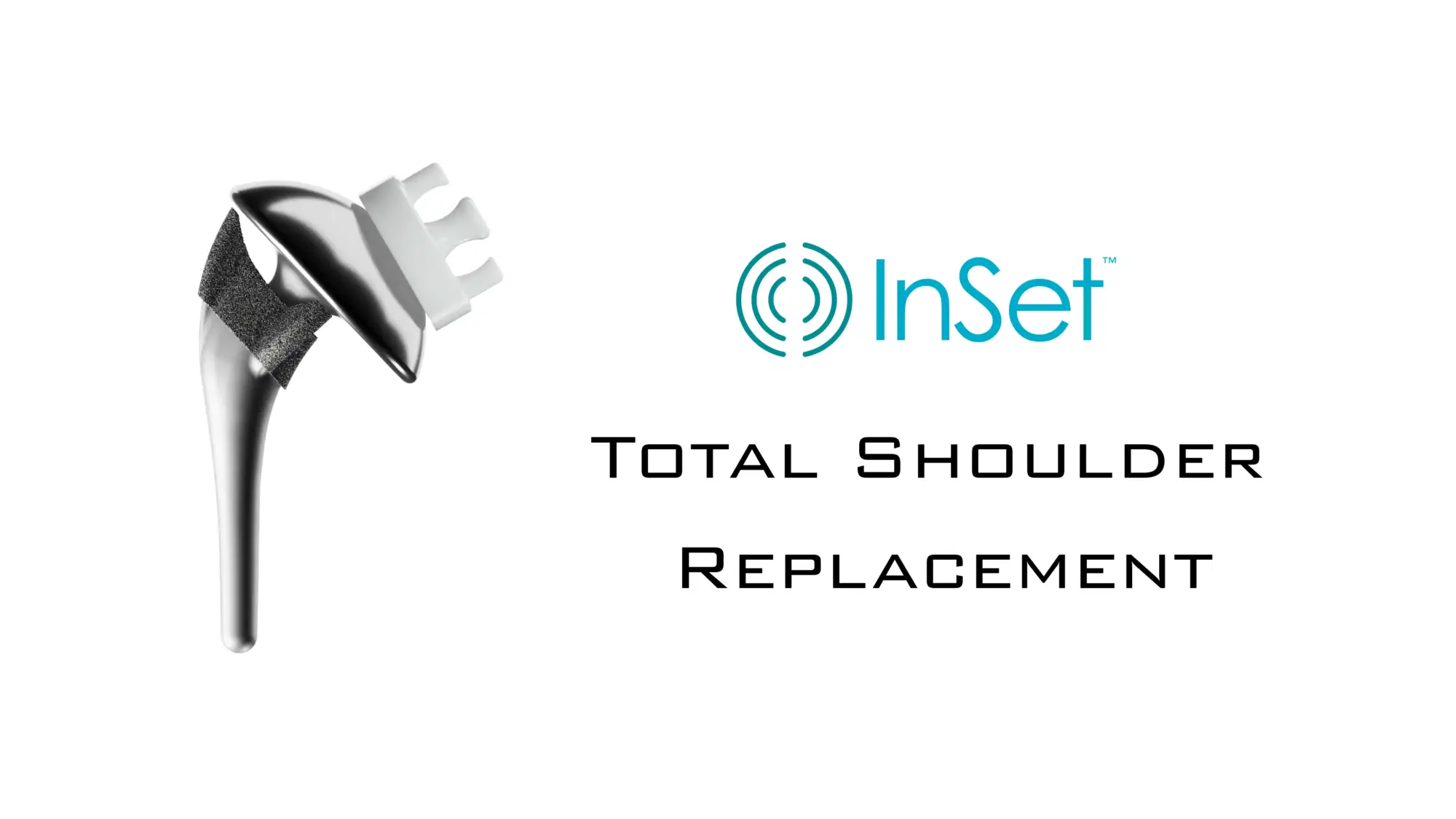InSet™ Total Shoulder Replacement 